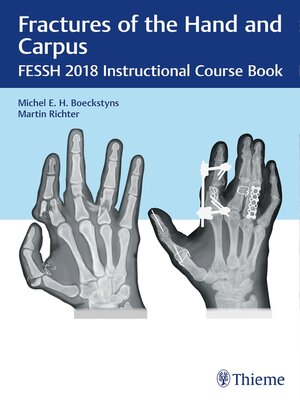 cover image of Fractures of the Hand and Carpus